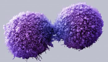 Pancreatic cancer cells