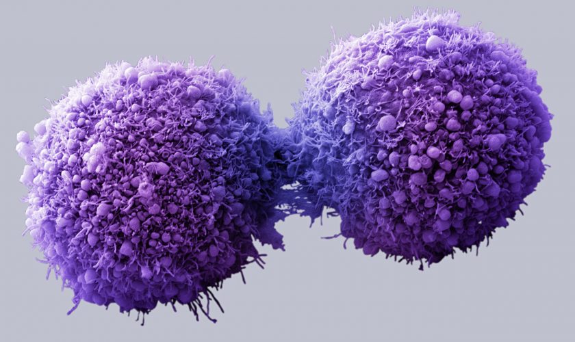 Pancreatic cancer cells