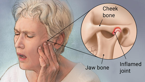 Temporomandibular-Joint-Dysfunction-Surgery-vs-Natural-Treatment