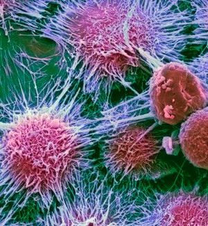 Types-of-Cancer-and-Alternative-Treatment