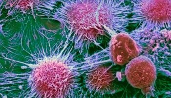 Types-of-Cancer-and-Alternative-Treatment